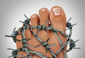 Barbed Wire Around Foot