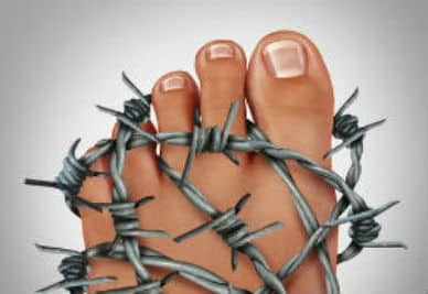 Barbed Wire Around Foot