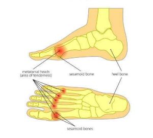 Illustrations of the Plantar Plate