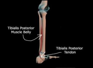 A diagram showing where the Tibialis muscle and tendon lie within the lower leg.