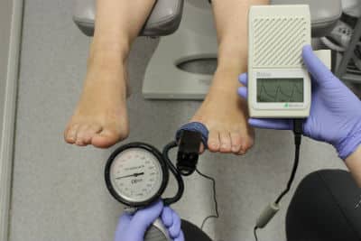 Diabetic Foot Testing