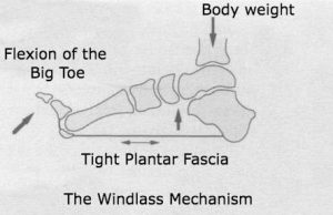 A diagram of the Windlass Mechanism which involves the plantar fascia
