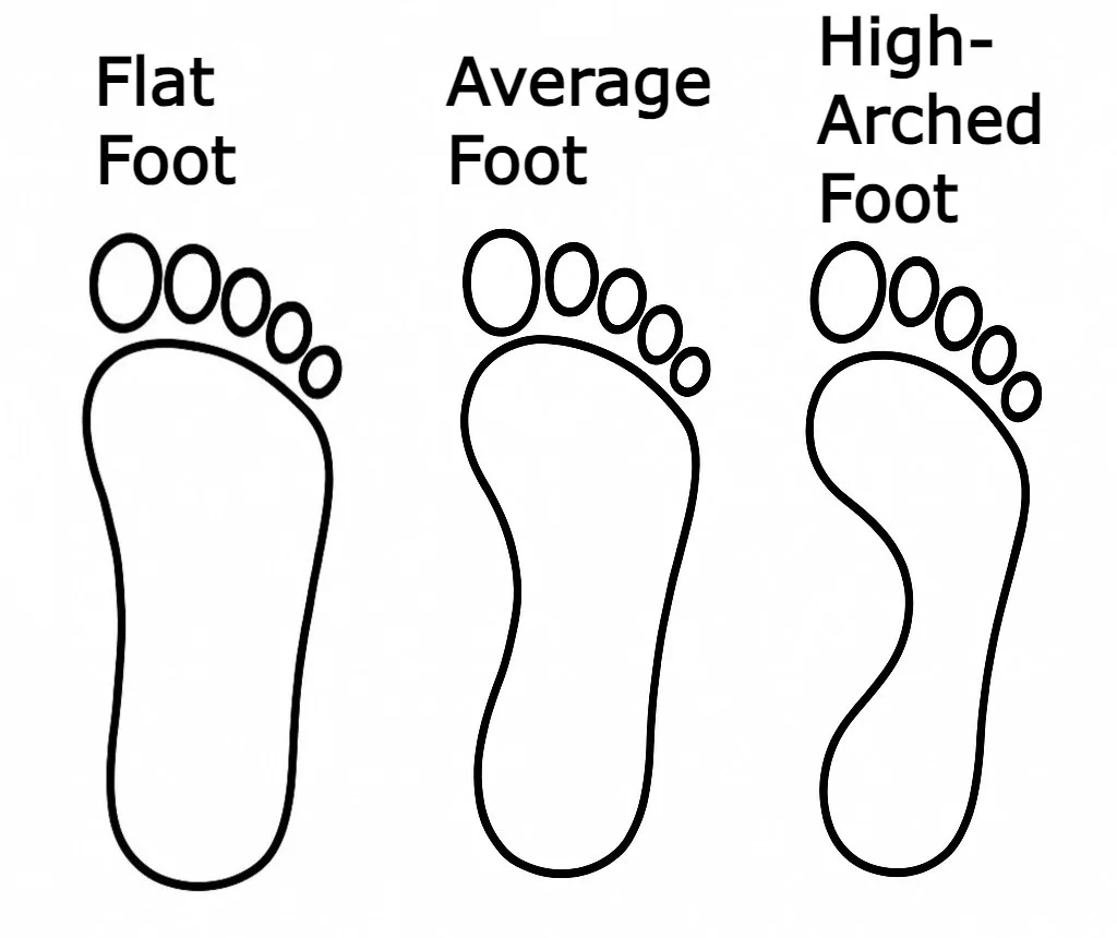 Wet footprint test for acquired flat foot