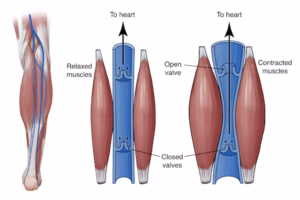 Diagram of calf muscles pumping veinous blood back to heart.